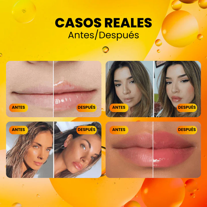 Voluminizador de Labios Derol