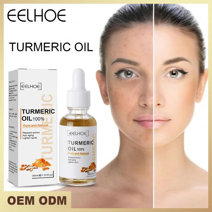 Aceite Esencial de Cúrcuma EELHOE