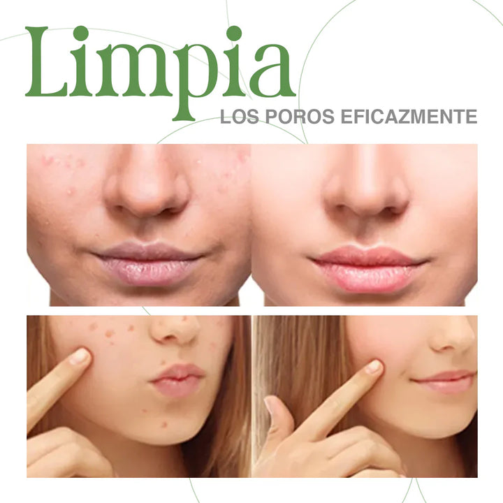 Mascarilla Cutis Limpio GREEN